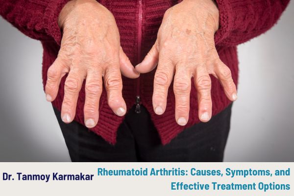 Rheumatoid Arthritis: Causes, Symptoms, and Effective Treatment Options